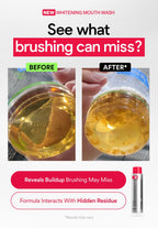 iD Stain Whitening Mouthwash